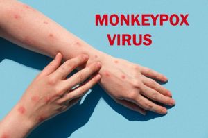 Panggilan Untuk Relawan North West Dalam Uji Coba Vaksin Cacar Monyet
